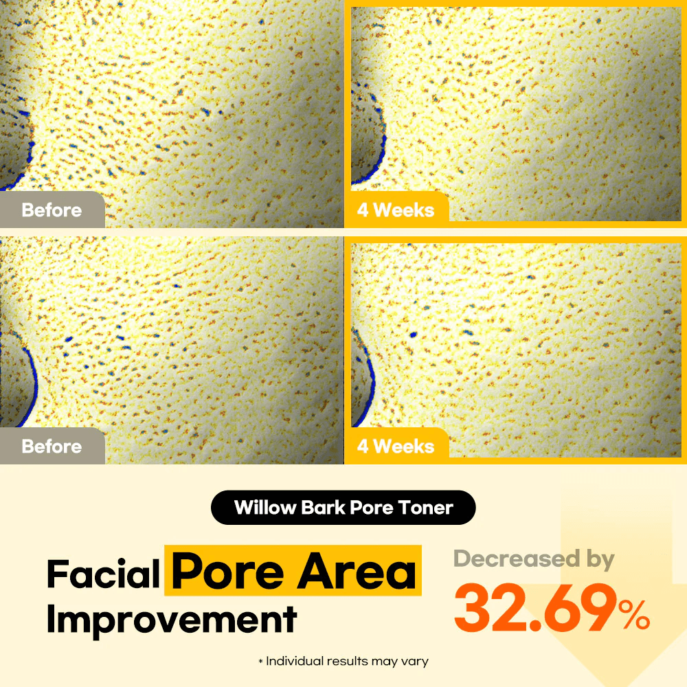 Lesimo Willow Bark Pore Toner