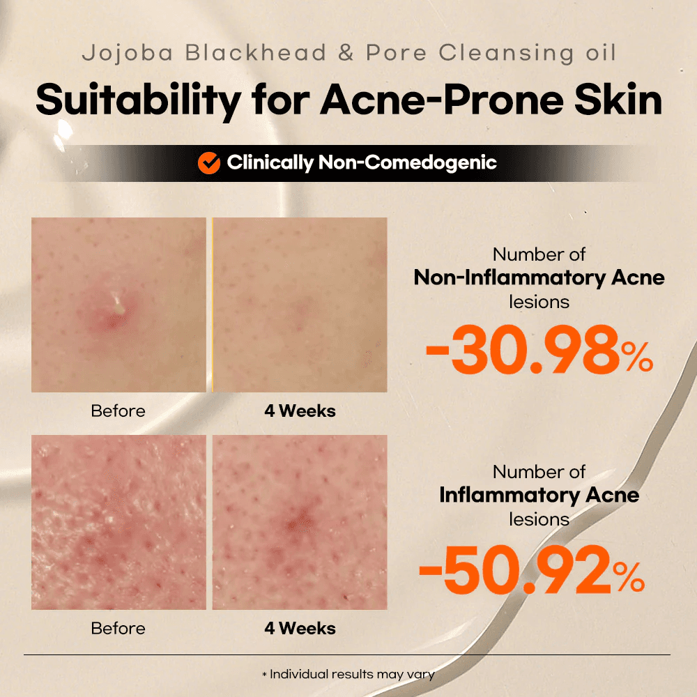 Lesimo Jojoba Blackhead & Pore Cleansing Oil