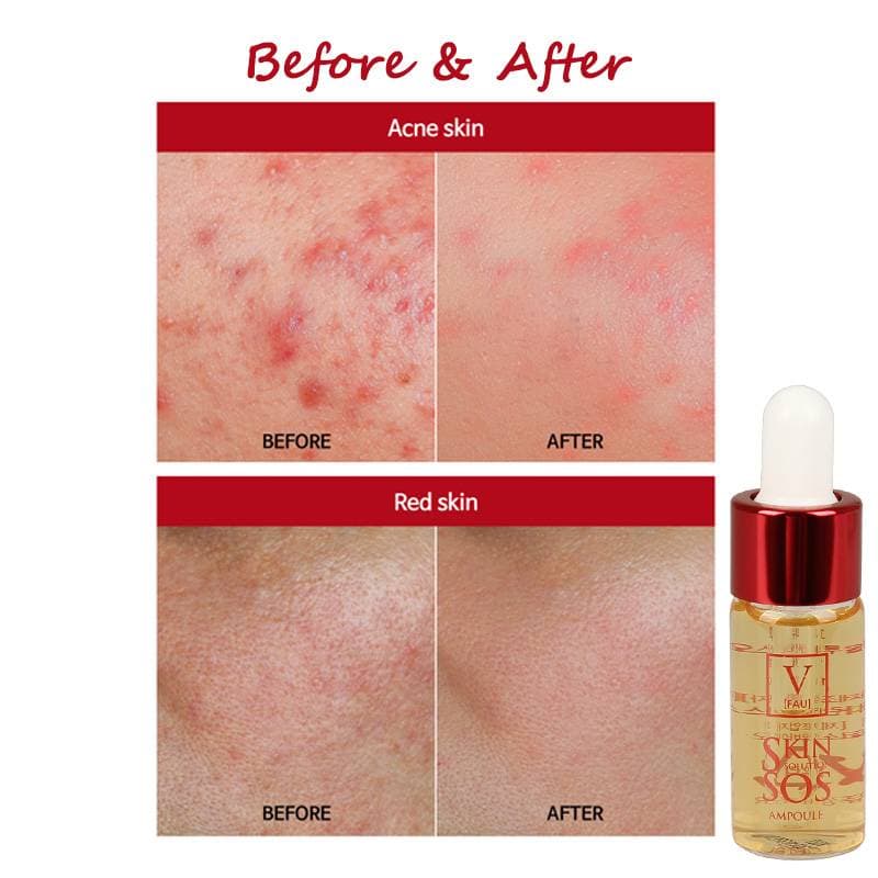 FAU Skin Solution SOS Ampoule — image 8