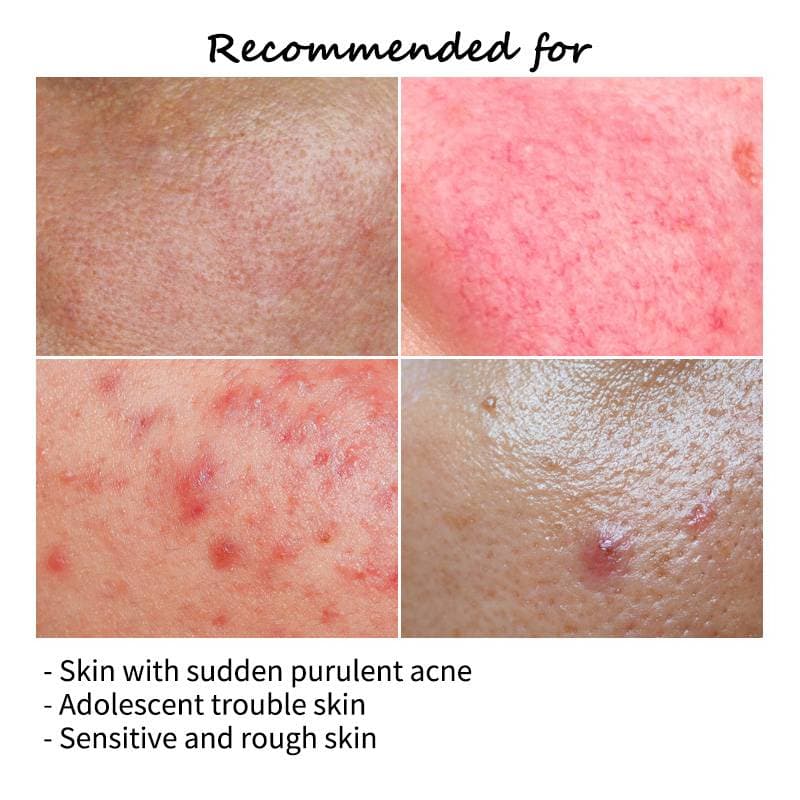 FAU Skin Solution SOS Ampoule — image 9