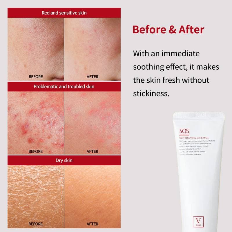 FAU Skin Solution SOS Cream — image 6