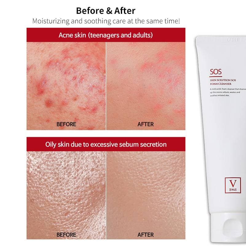 FAU Skin Solution SOS Foam Cleanser — image 6