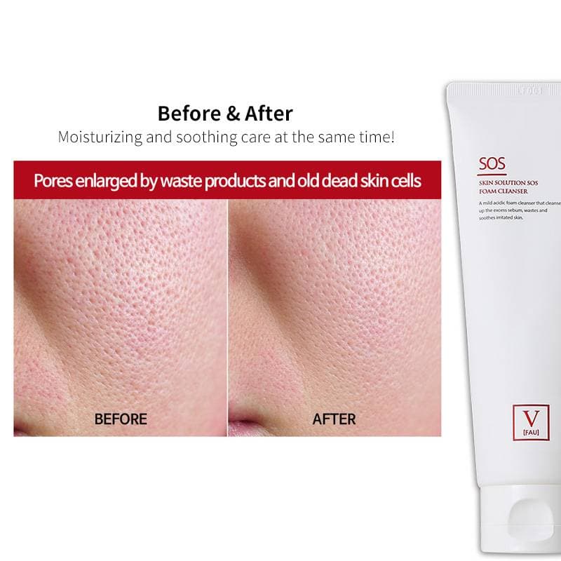 FAU Skin Solution SOS Foam Cleanser — image 7