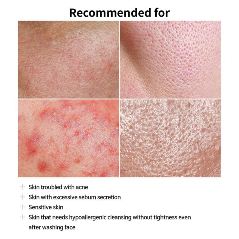 FAU Skin Solution SOS Foam Cleanser — image 9