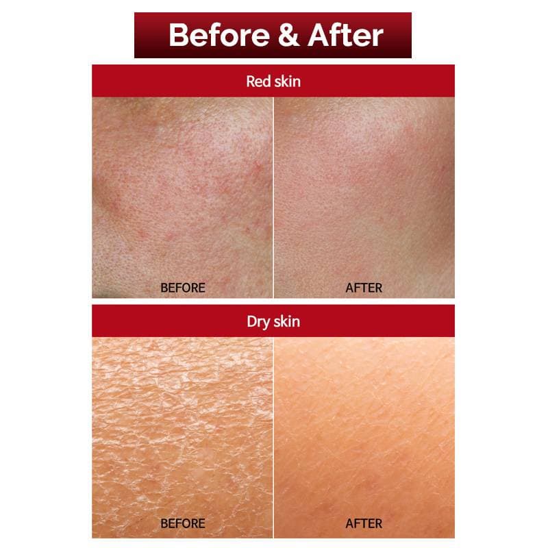 FAU Skin Solution SOS Mask — image 2