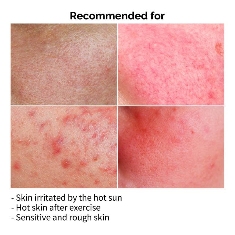 FAU Skin Solution SOS Mask — image 10