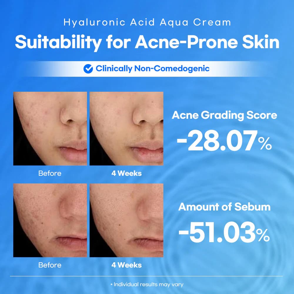 Lesimo Hyaluronic Acid Aqua Cream — image 7