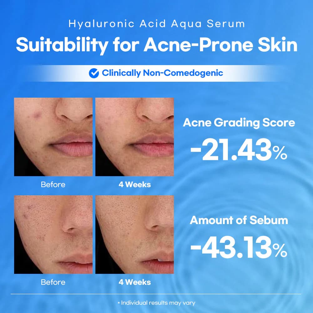 Lesimo Hyaluronic Acid Aqua Serum — image 7