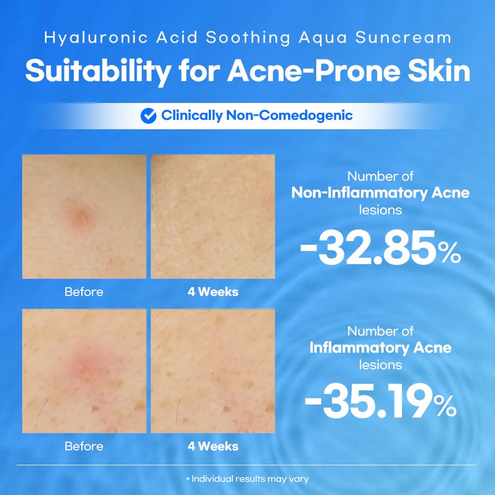 Lesimo Hyaluronic Acid Soothing Aqua Suncream — image 7