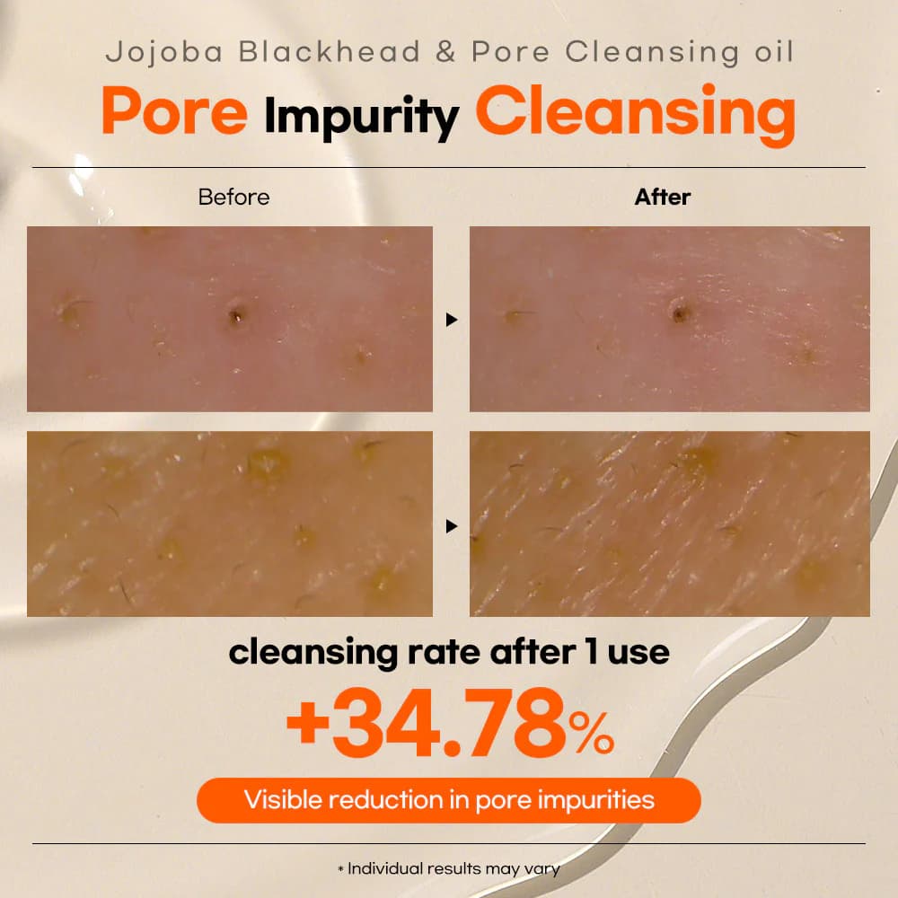 Lesimo Jojoba Blackhead & Pore Cleansing Oil — image 9