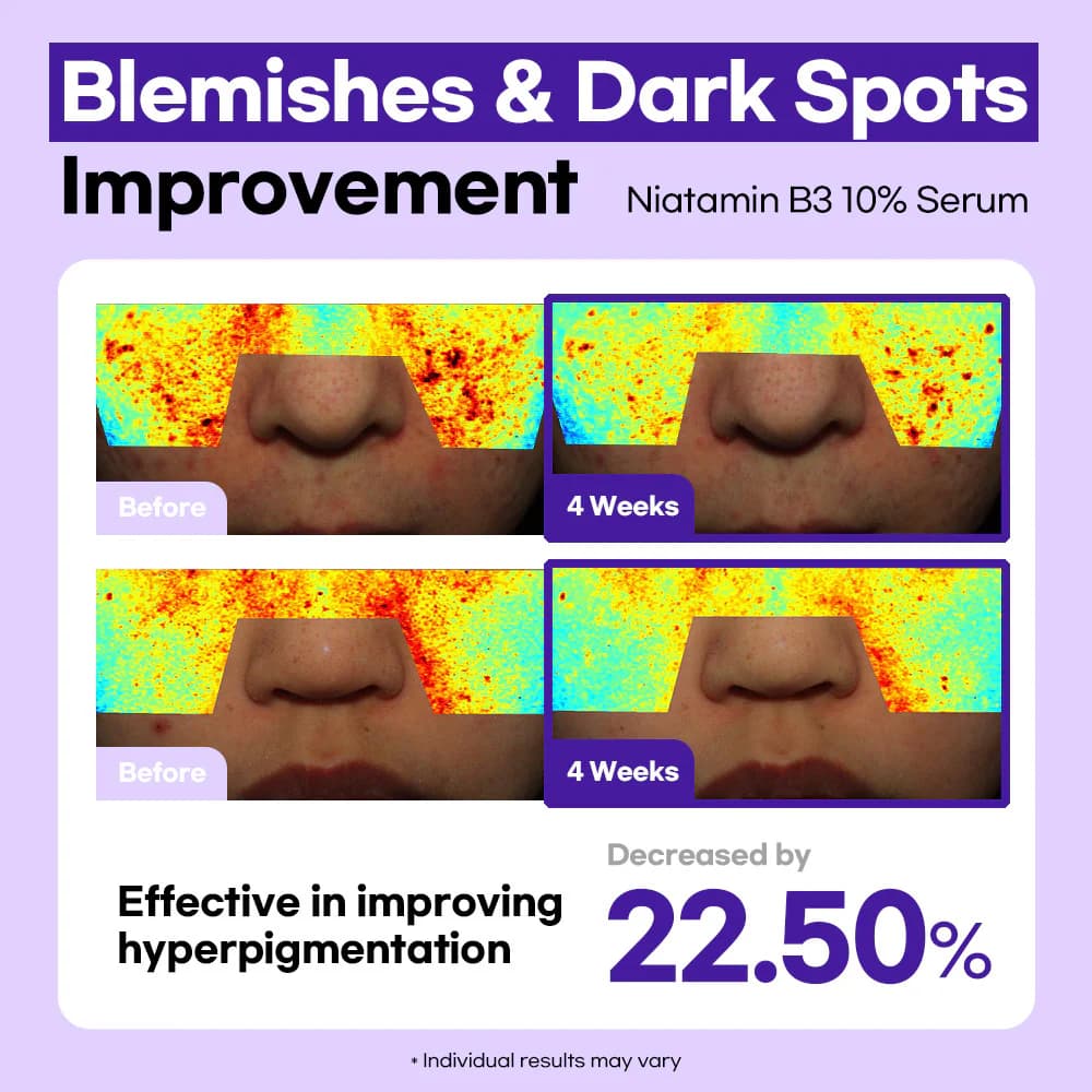 Lesimo Niatamin B3 10% Serum — image 8