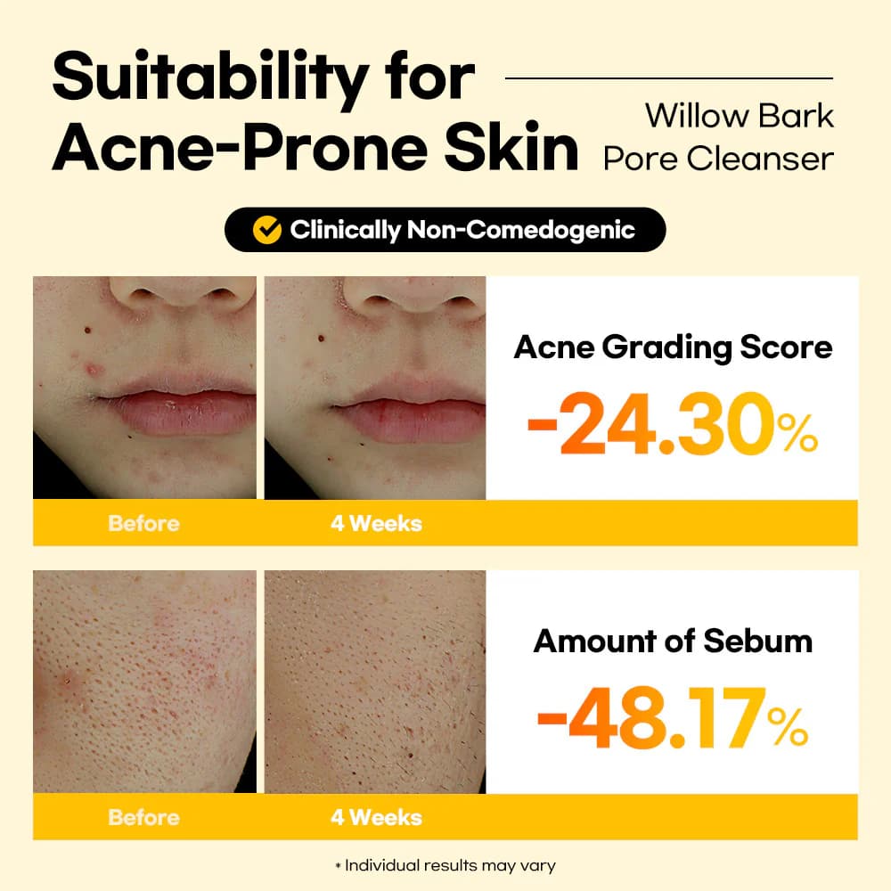 Lesimo Willow Bark Pore Cleanser — image 7