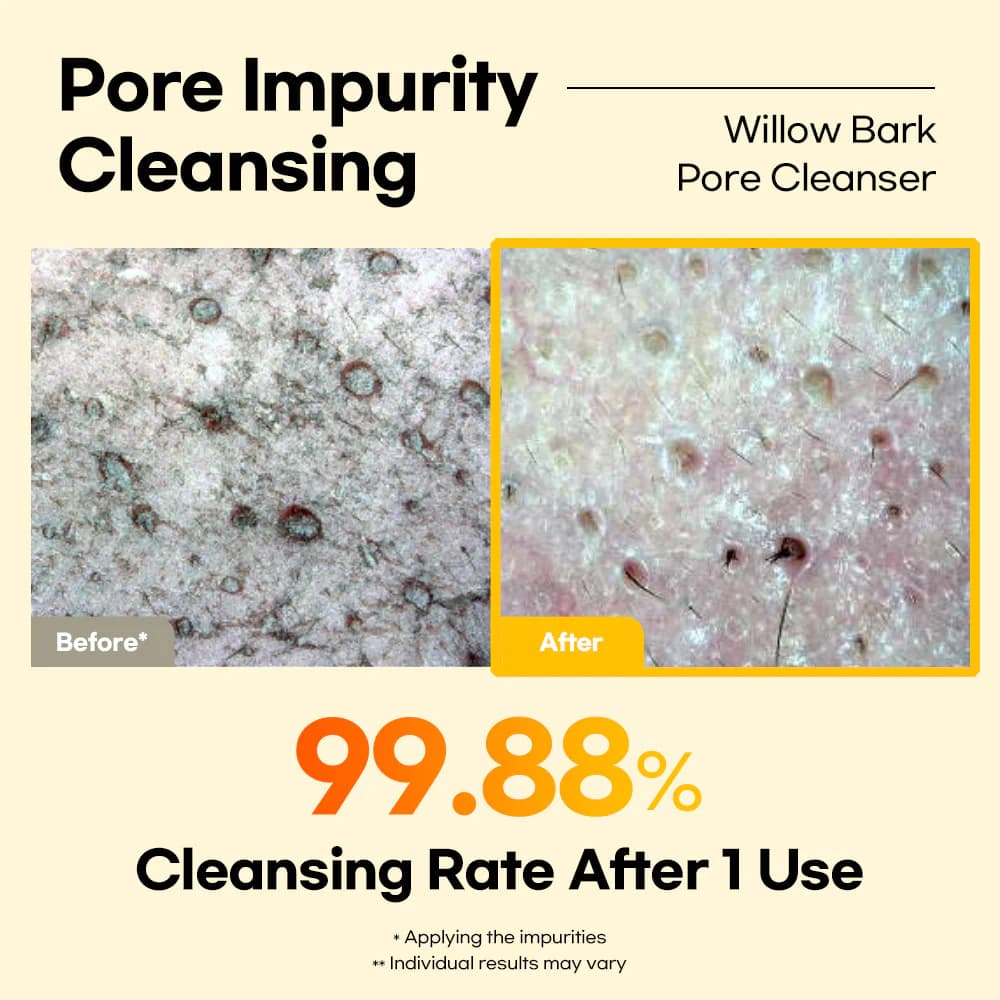 Lesimo Willow Bark Pore Cleanser — image 8