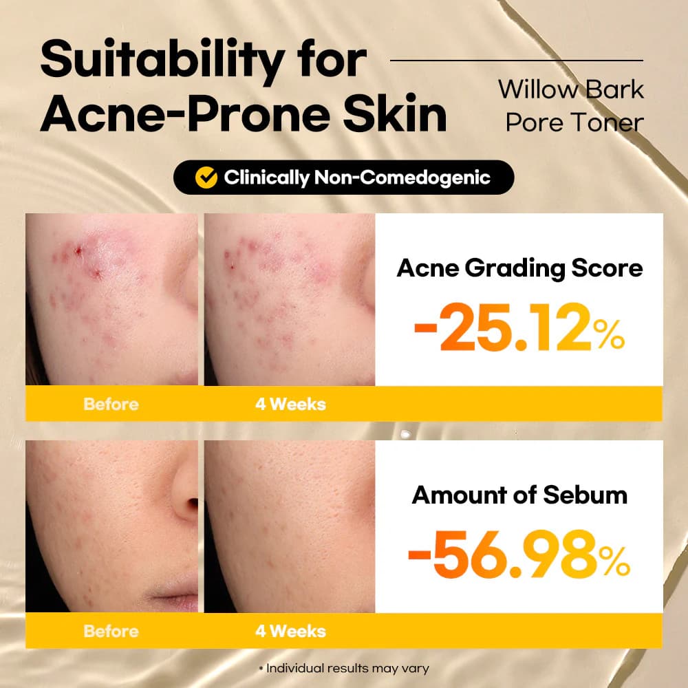 Lesimo Willow Bark Pore Toner — image 3