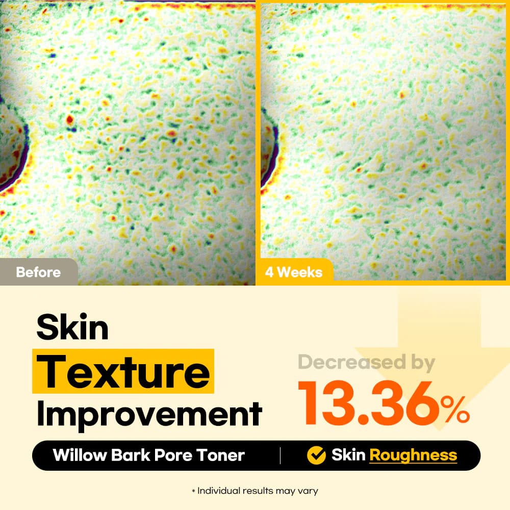 Lesimo Willow Bark Pore Toner — image 5